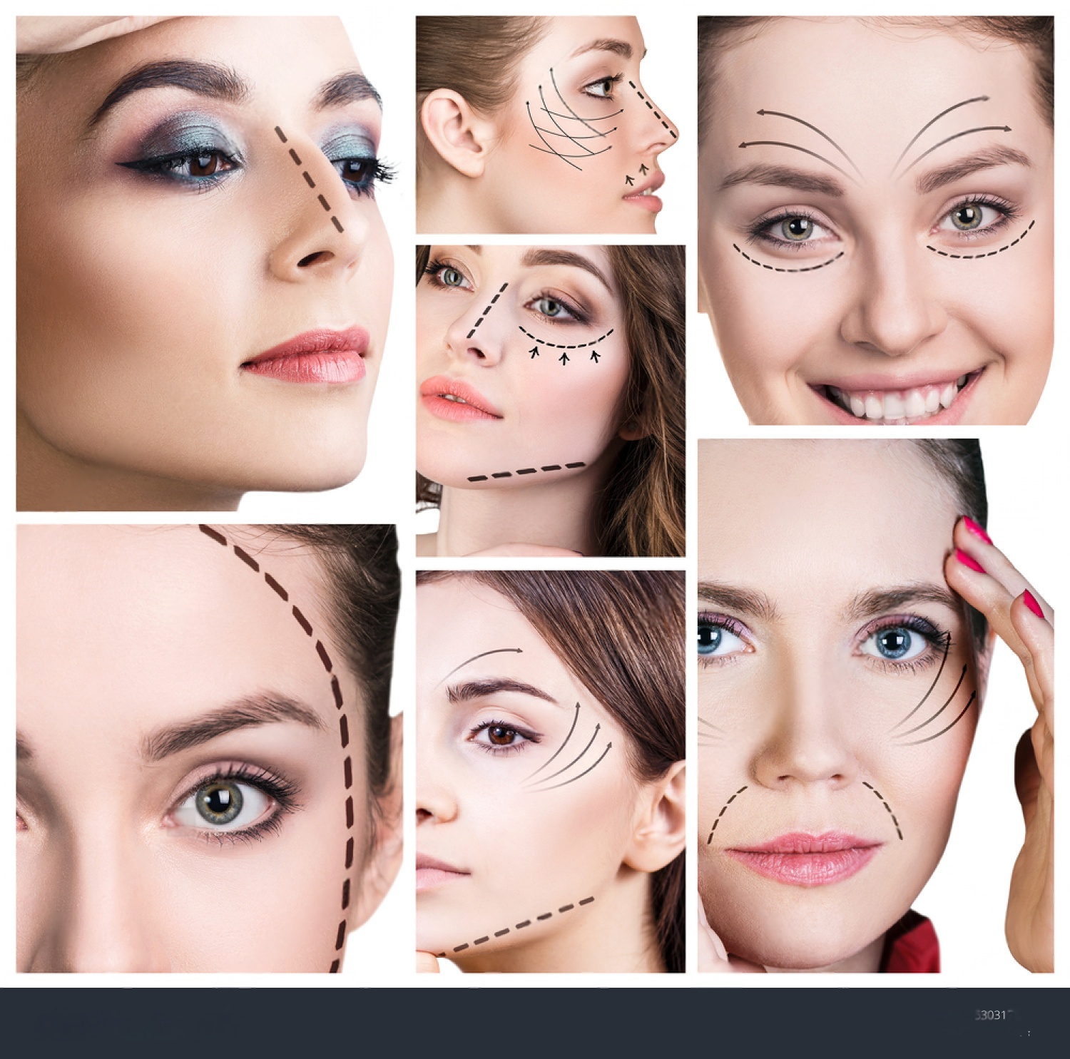 plastic-surgery-collage