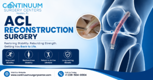 ACL Reconstruction Surgery: Recovery, Benefits & Procedure